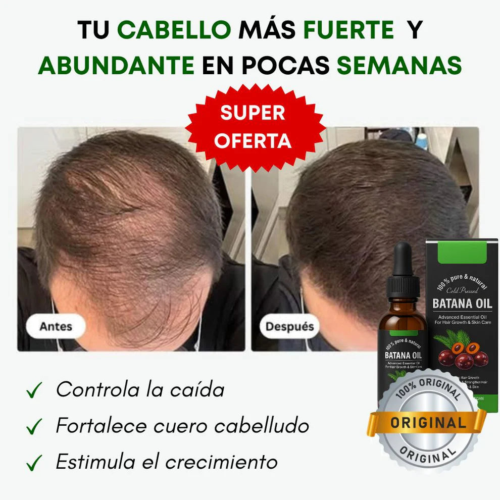 Aceite Batana UpSe